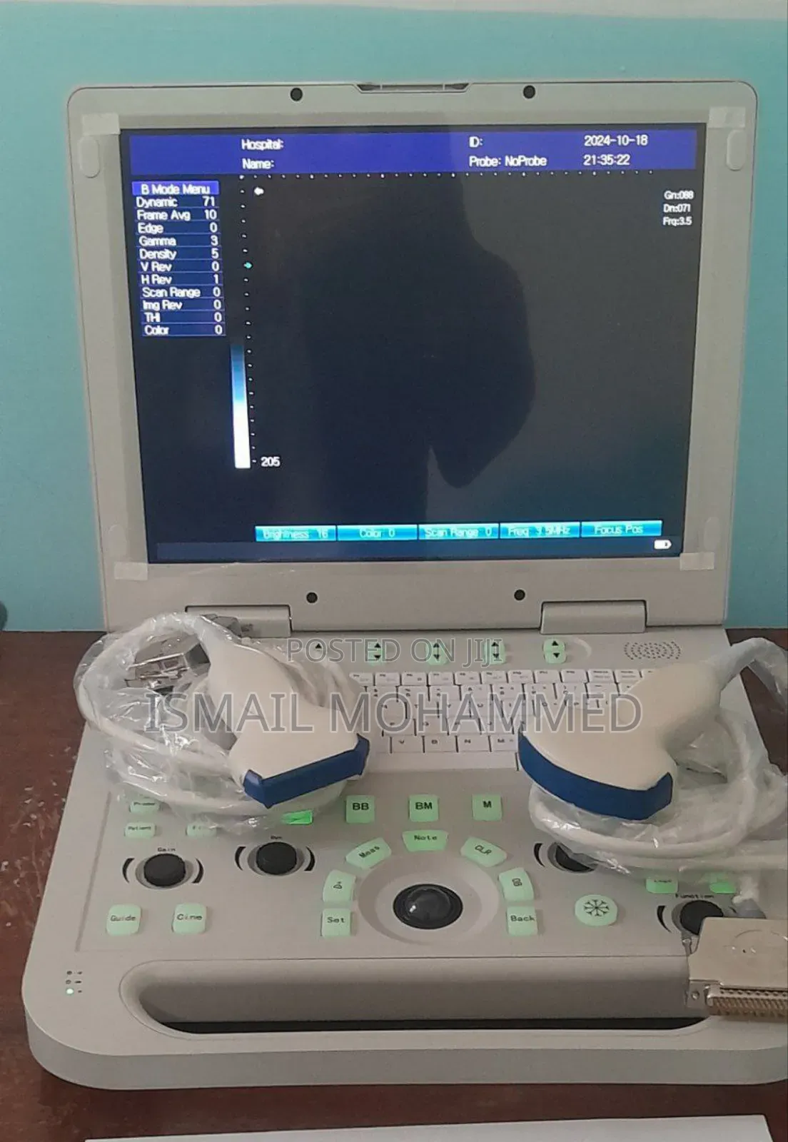 Sonostar Ultrasound