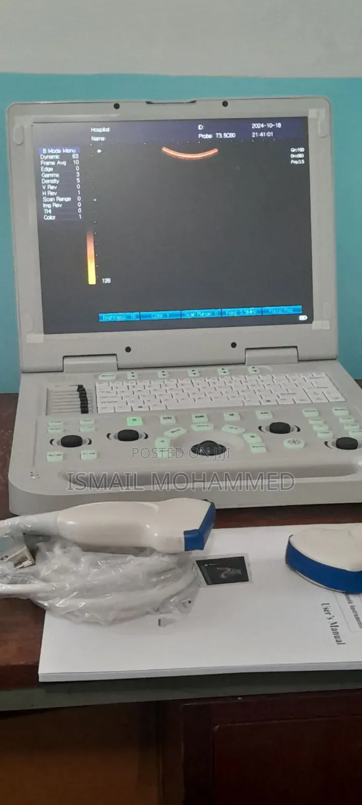 Sonostar Ultrasound