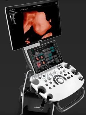 Photo - Colo Doppler 3d/4d Ultrasound