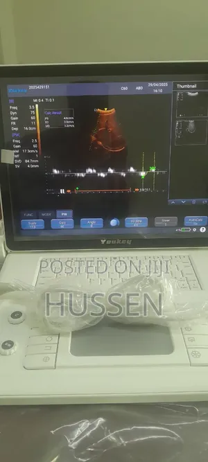 Photo - New Sonostar Ultrasound Machine