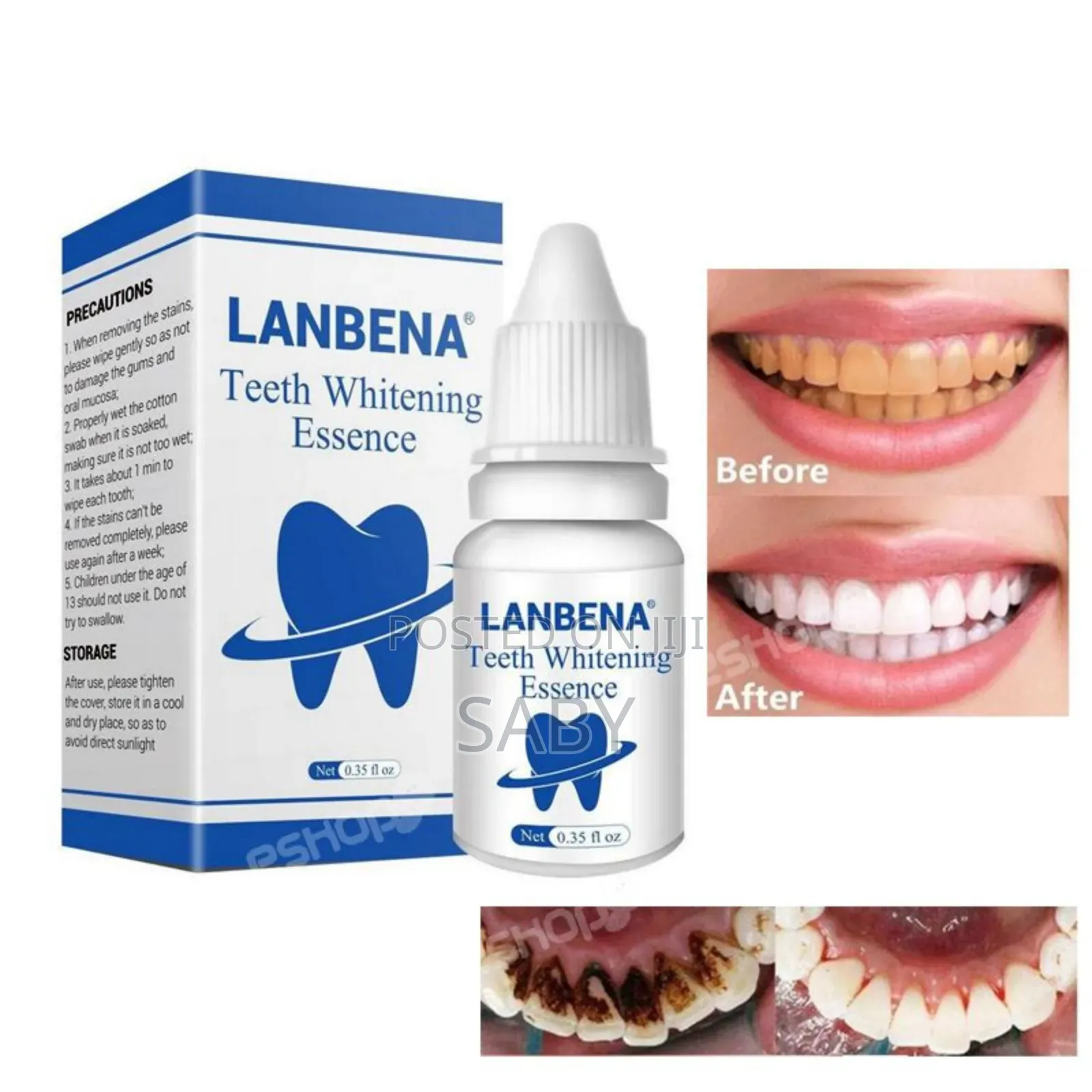 Lanbena Teeth Whitening