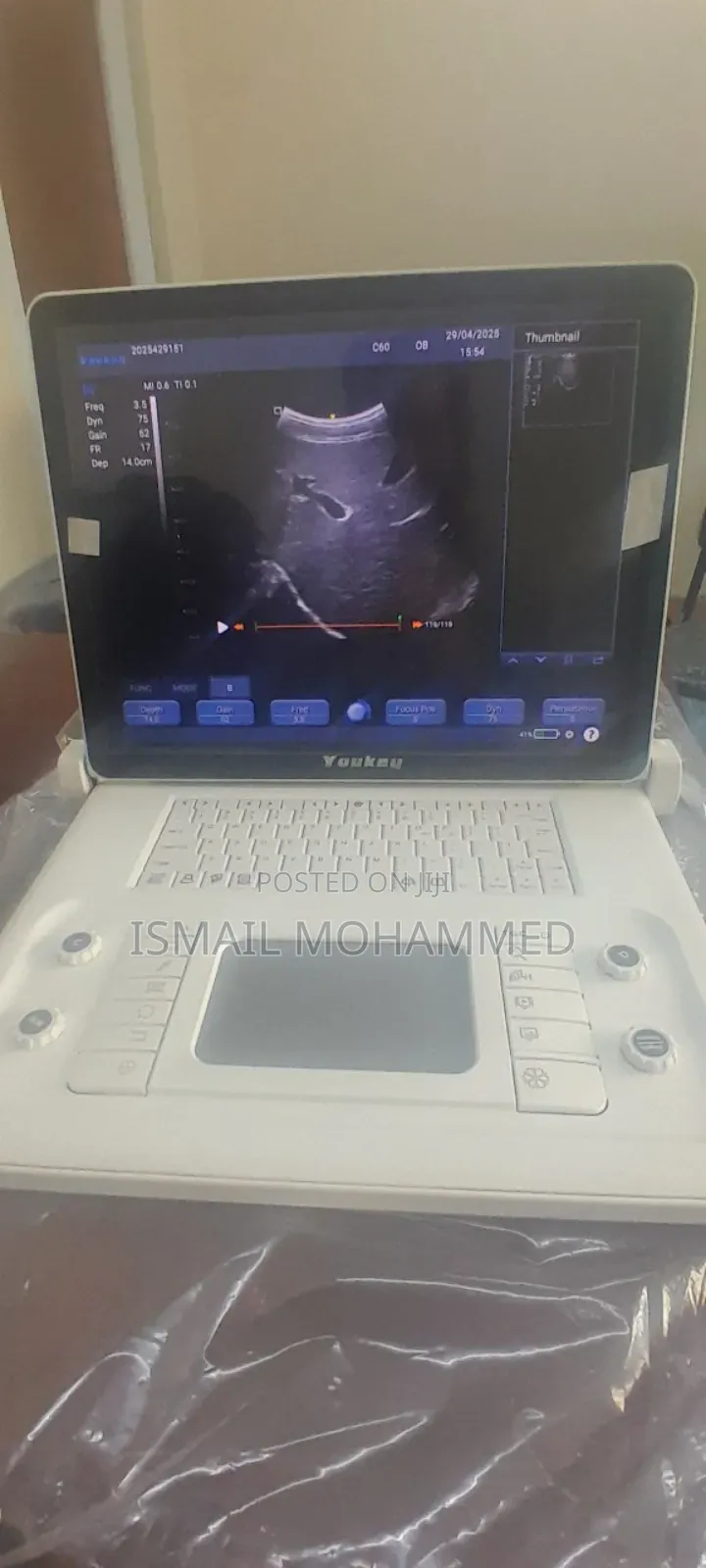 F6 Ultrasound