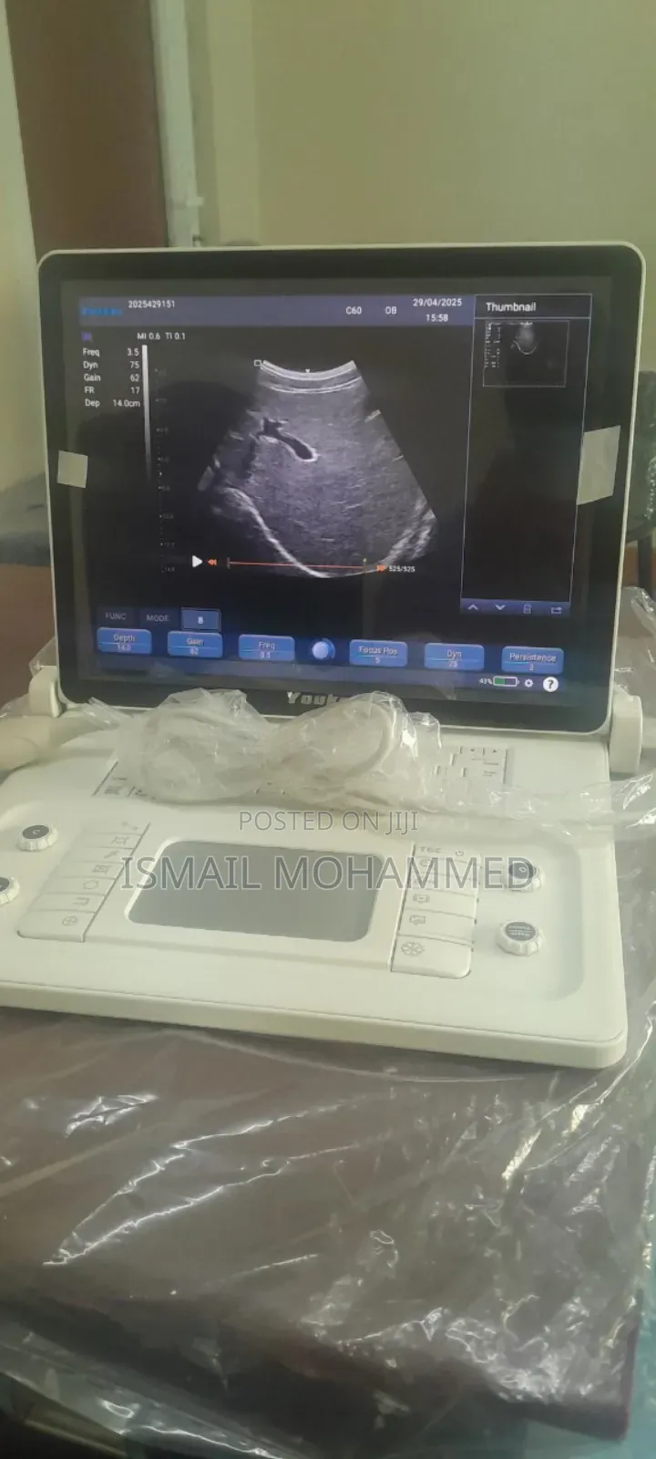 F6 Ultrasound