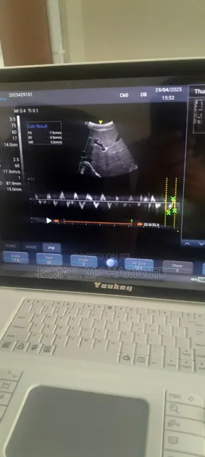 F6 Ultrasound