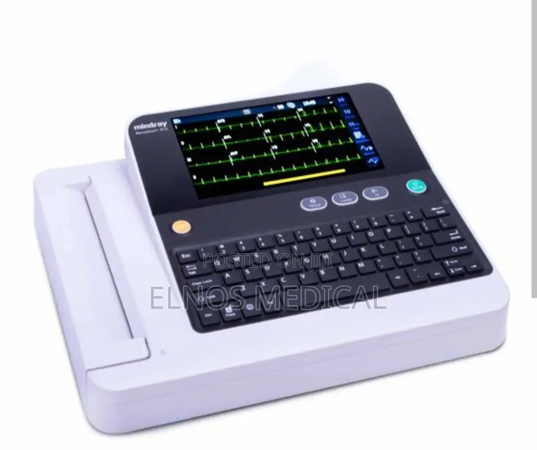 Ecg(Electrocardiogram)