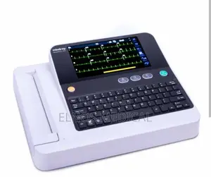 Photo - Ecg(Electrocardiogram)