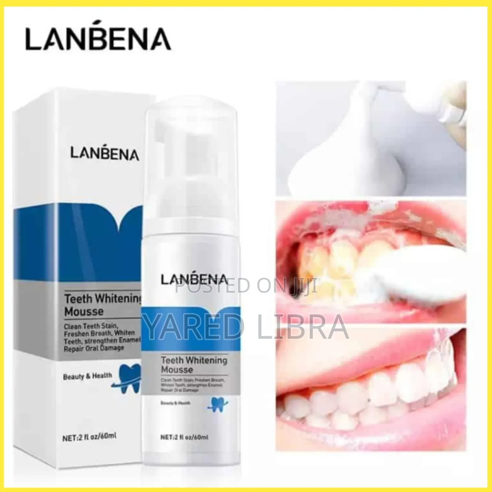Lanbena Teeth Whitening ጥርስ ያነፃል