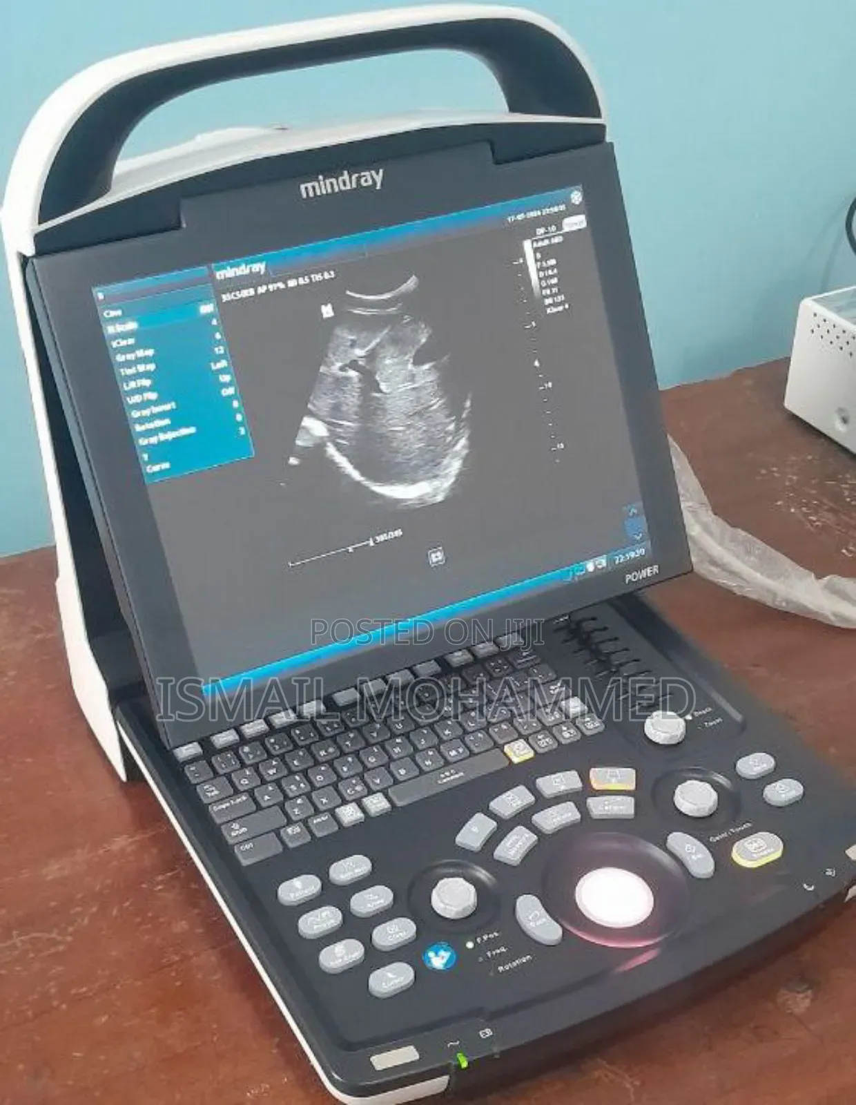 Mindray Dp 10 Ultrasound