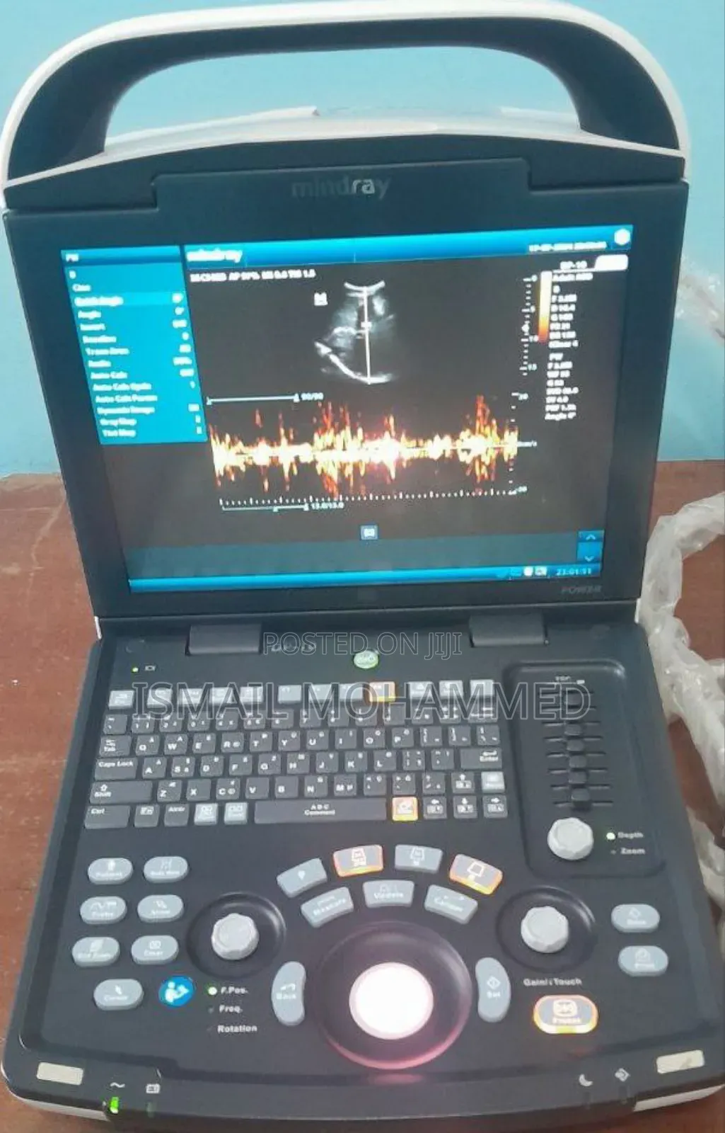 Mindray Dp 10 Ultrasound