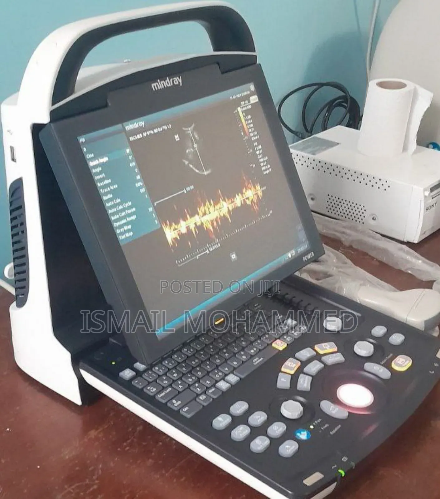 Mindray Dp 10 Ultrasound