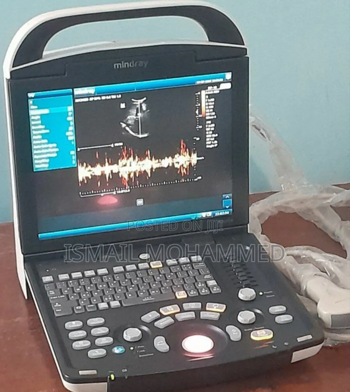 Mindray Dp 10 Ultrasound