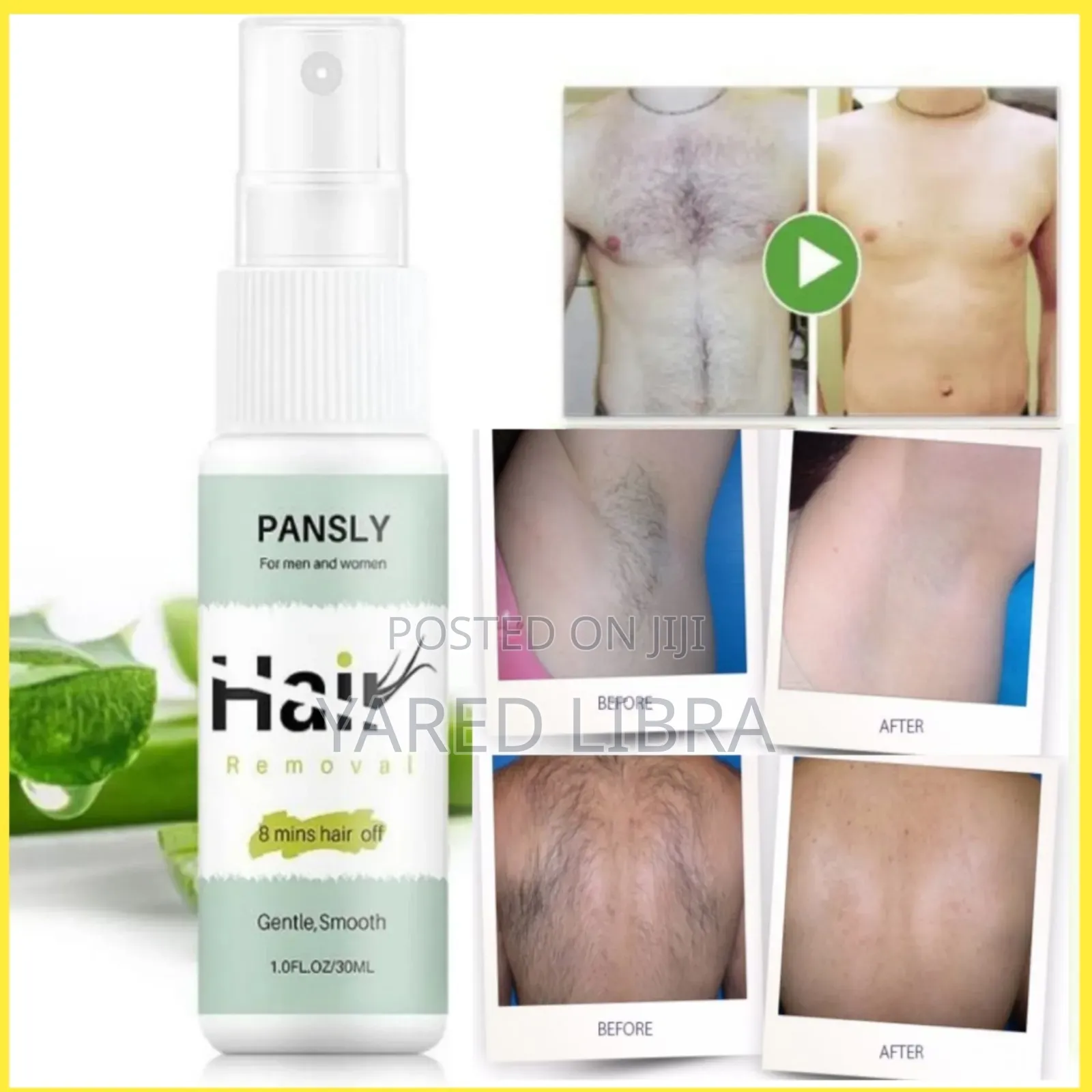 Pansly Hair Removed ፀጉር እንዳይመለስ አድርጎ ያጠፋል