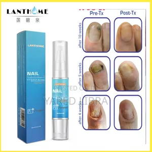 Photo - Nail በፈንገስ የተጎዳ ጥፍር እንዲበቅል ያደርጋል