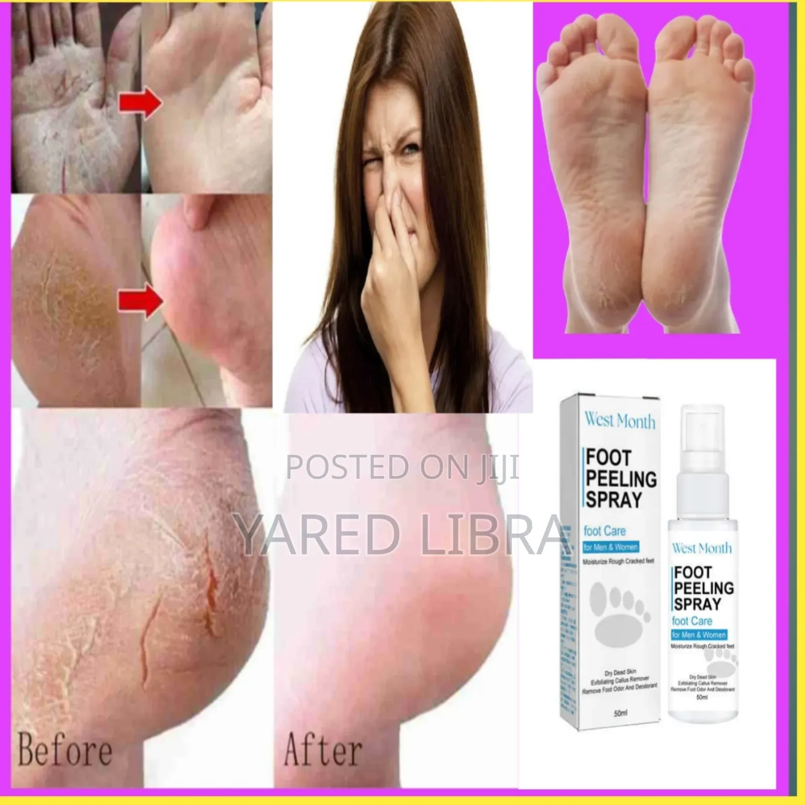 Foot Odor Spray የእግር ላብ ጠረን ያስወግዳል