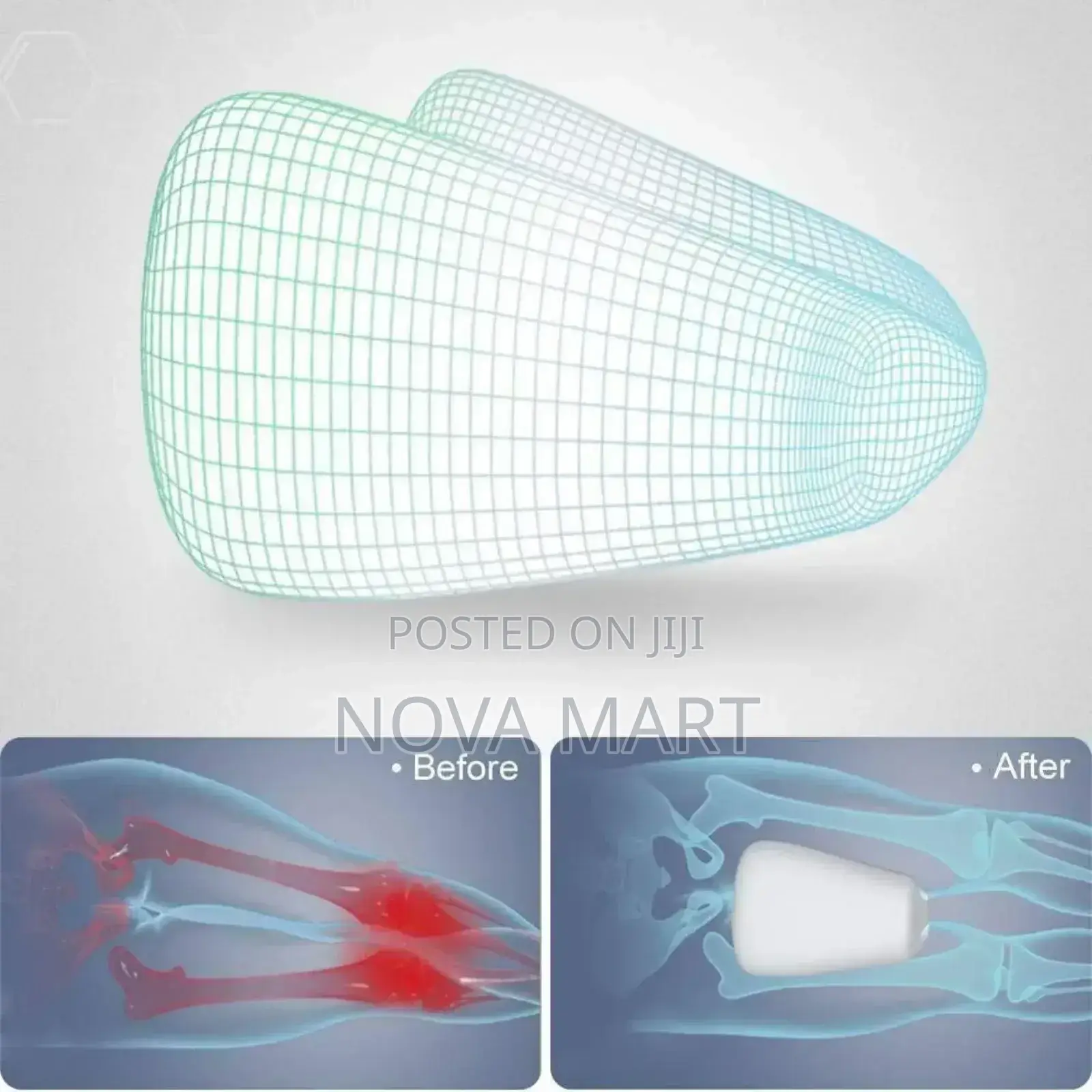 Orthopedic Leg/Knee Pillow