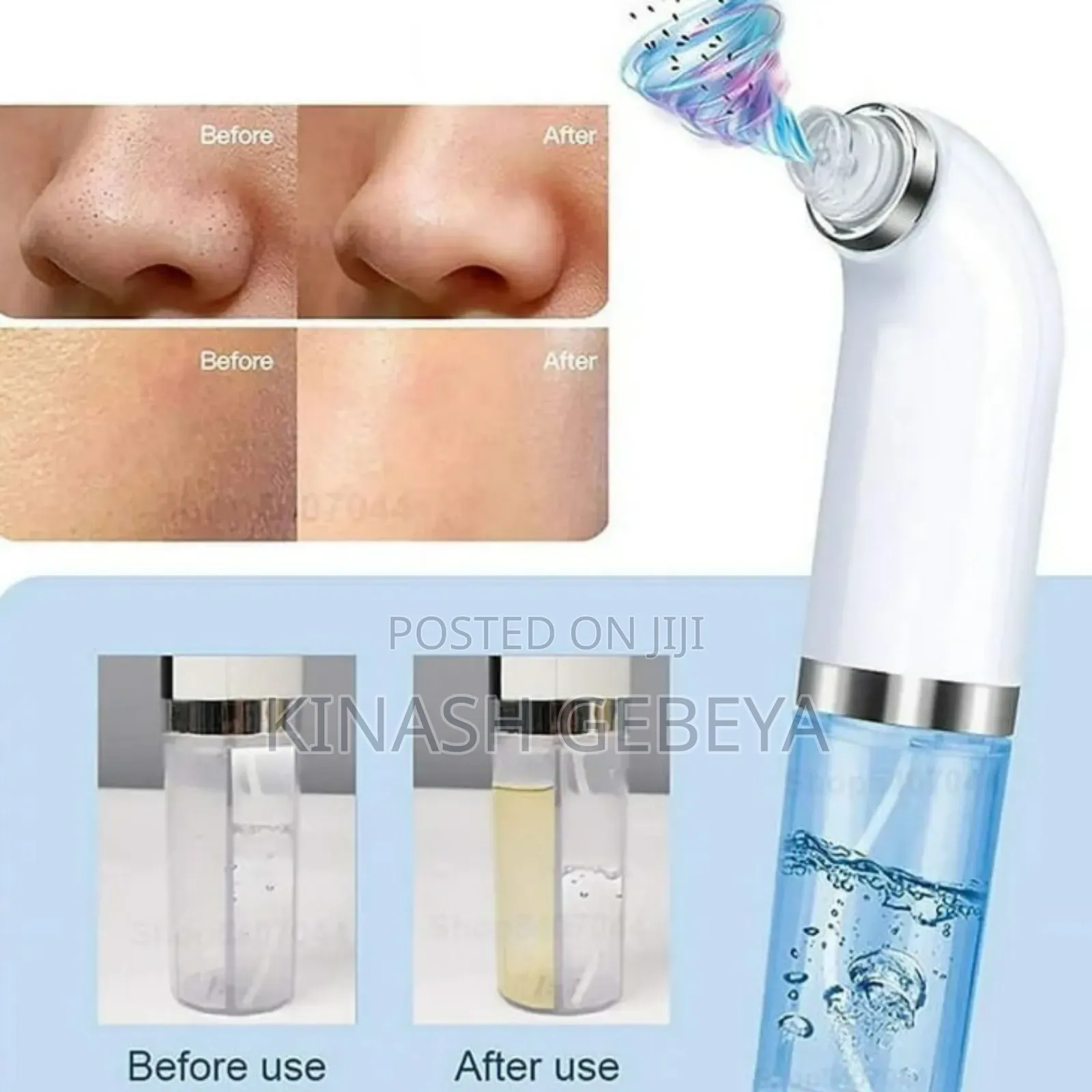 Super Bubble Face Skin Care Instrument(የፊት ቆዳ መጠበቂያ)