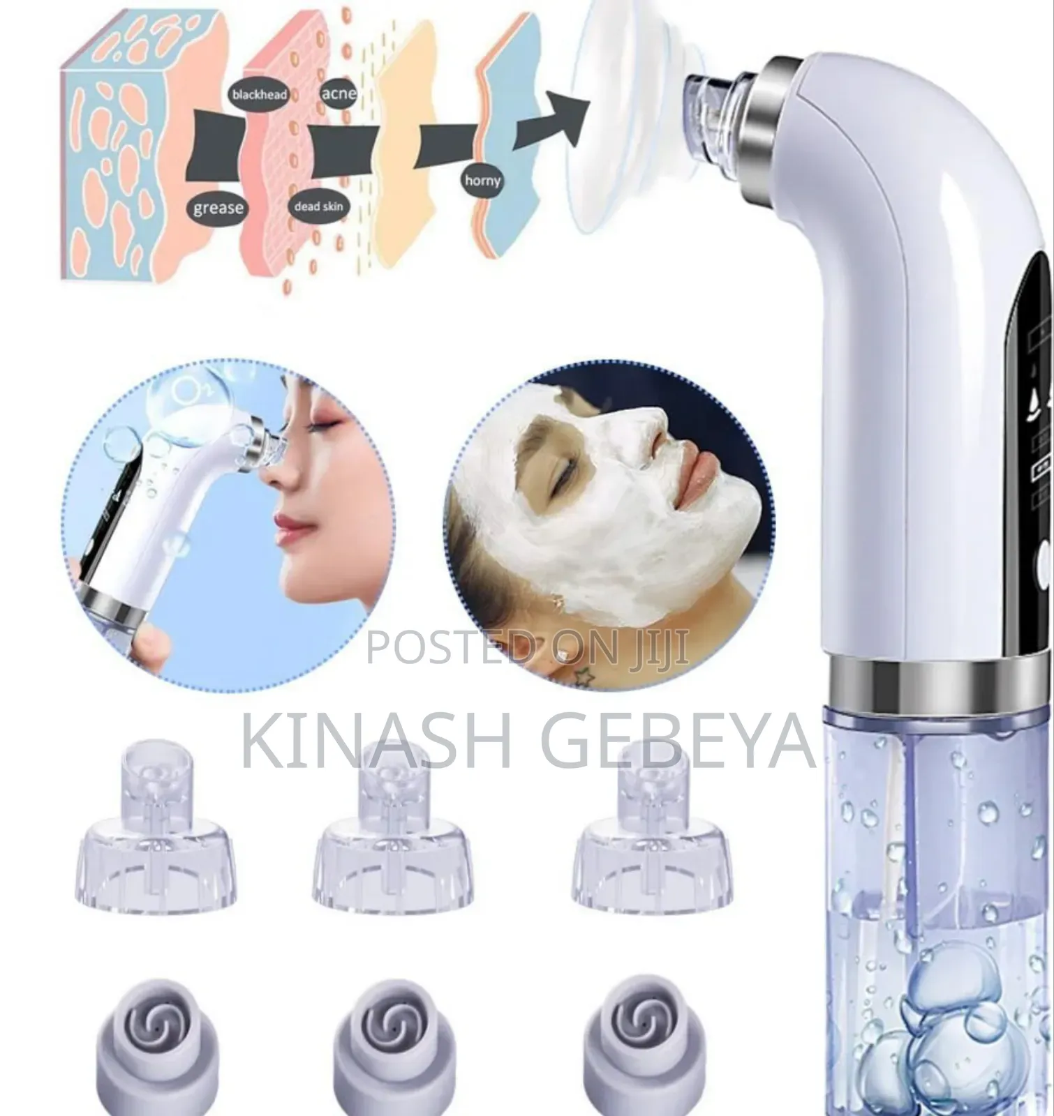 Super Bubble Face Skin Care Instrument(የፊት ቆዳ መጠበቂያ)