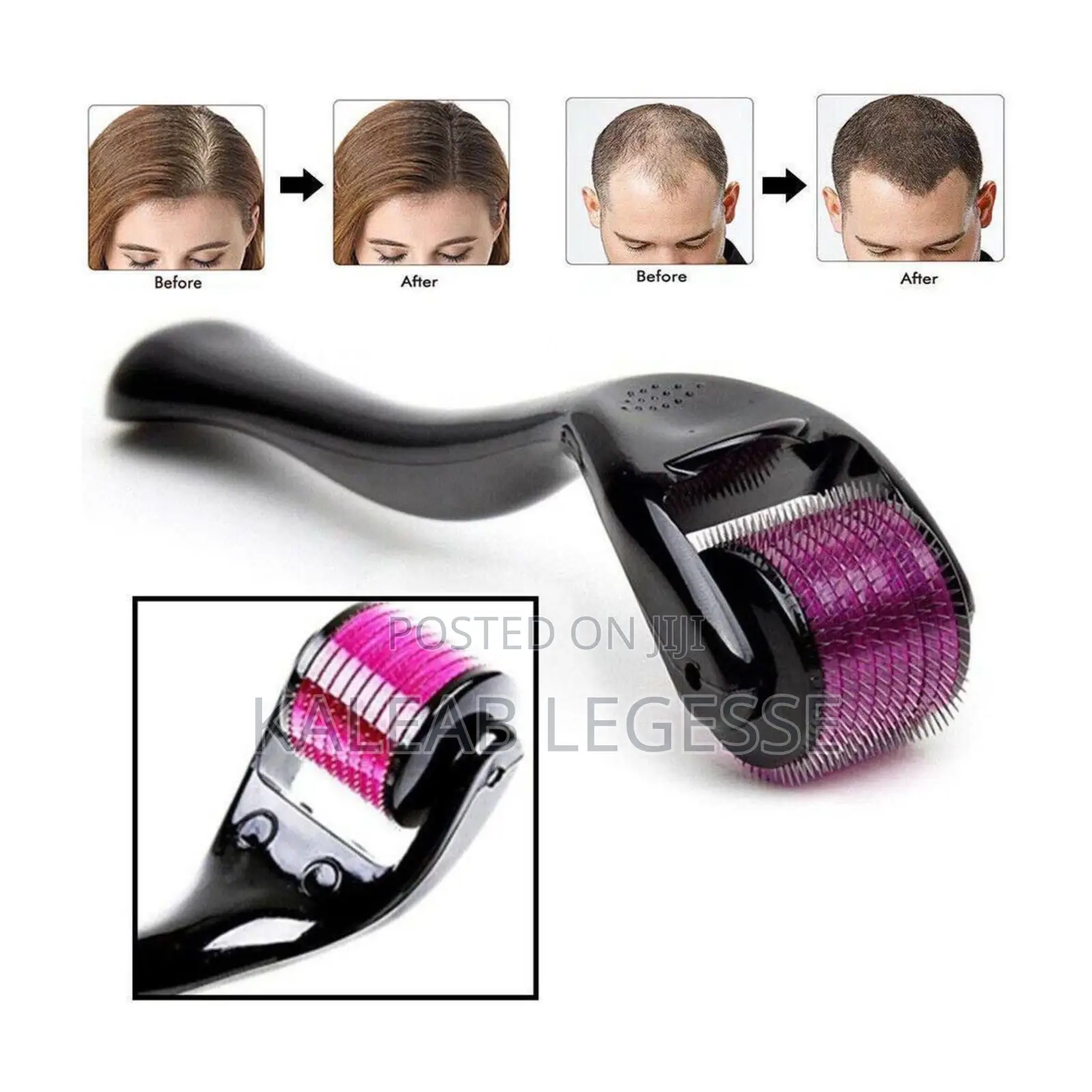 Derma Roller