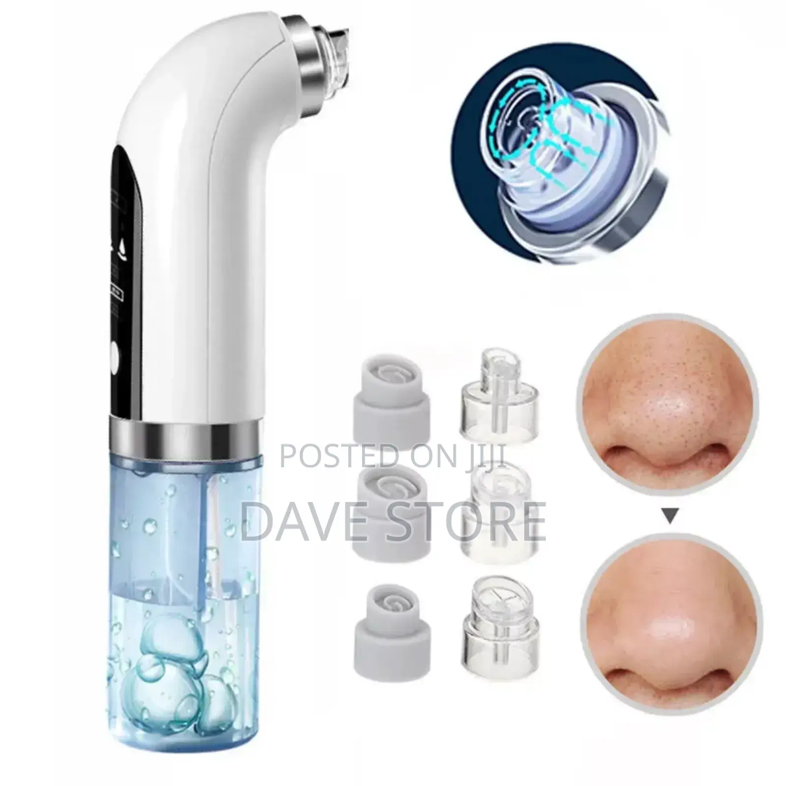 Super Micro Bubble Beauty Instrument Is a Skincare