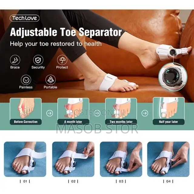 የአውራ ጣት ማስተካከያ / Bunion Corrector
