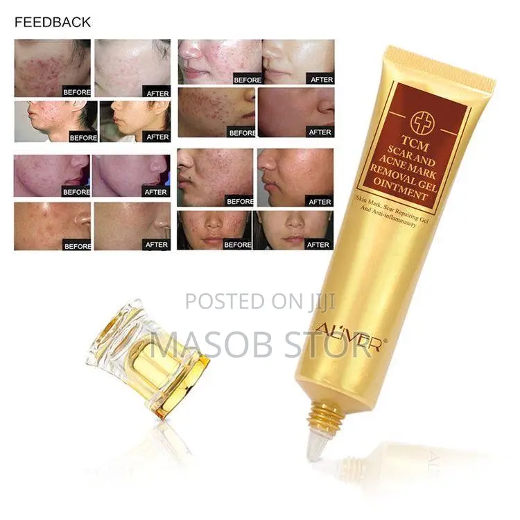 TCM Scar and Acne Mark Removal Gel Ointment/ የጠባሳ ማጥፊያ