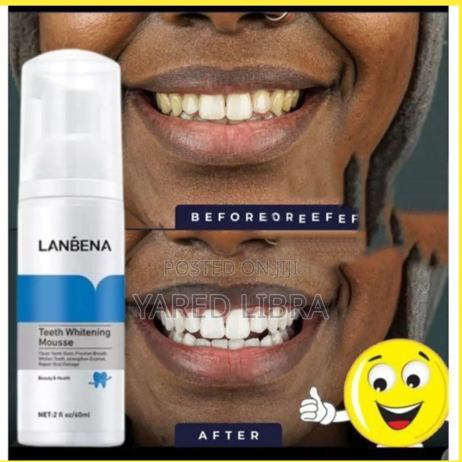 Lanbena ጥርስ ነጭ ያደርጋል