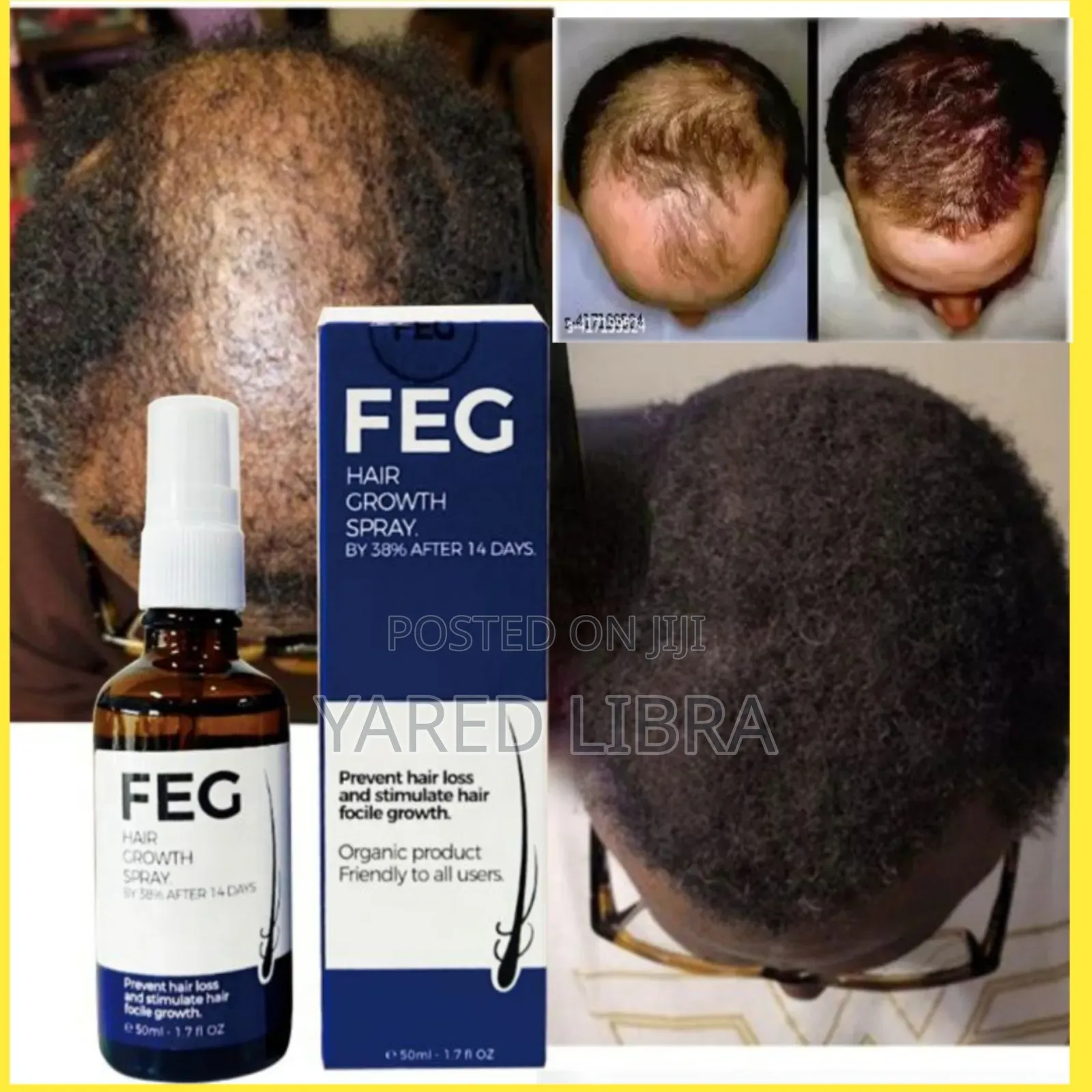 Feg ነተመለጠ የሳሳ ፀጉር ያሳድጋል