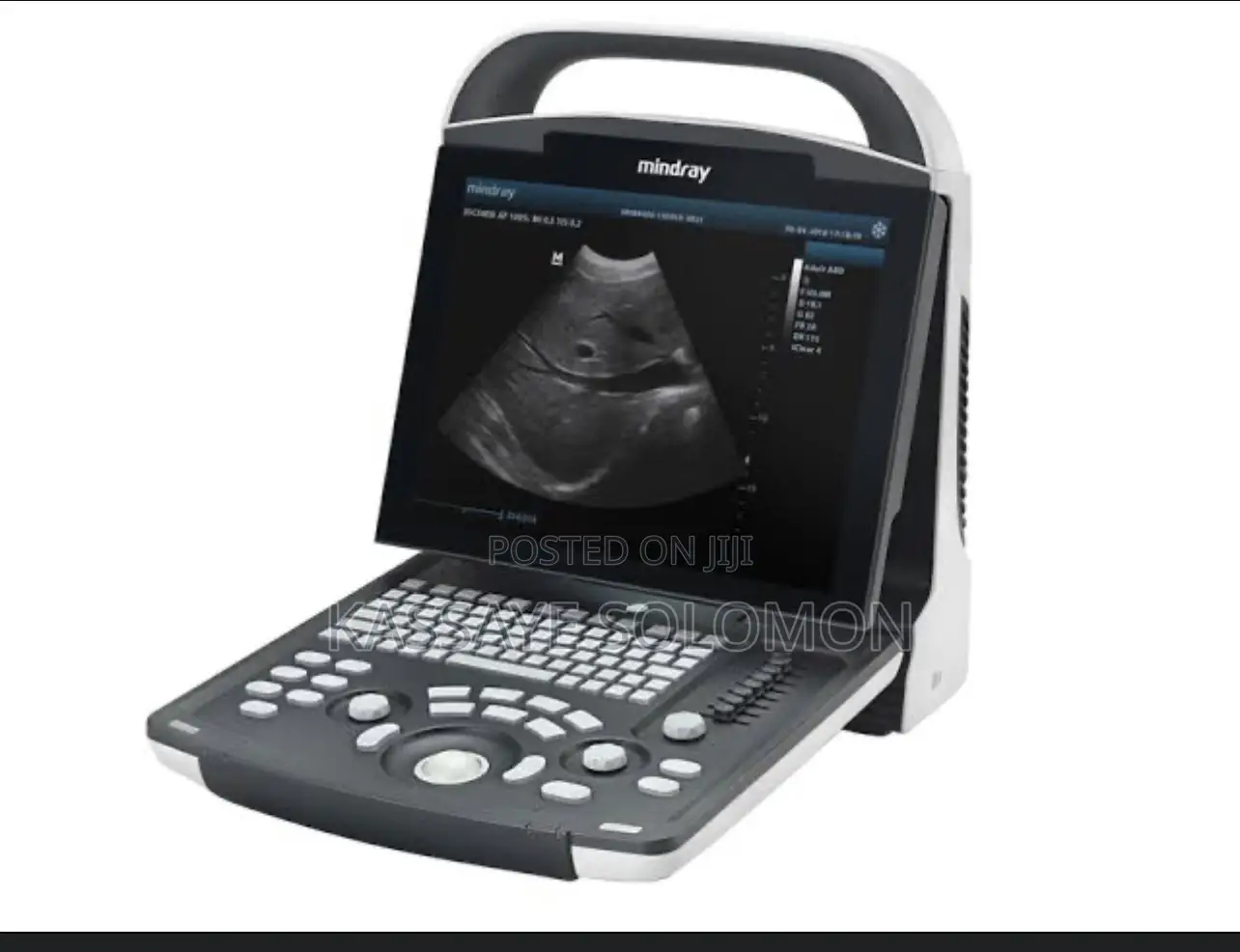 Dp 10 Ultrasound