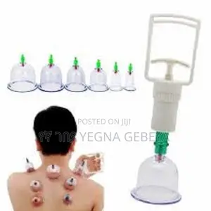 Photo - Suplory 12-pcs Cupping Kit Vacuum Air Suction Cups