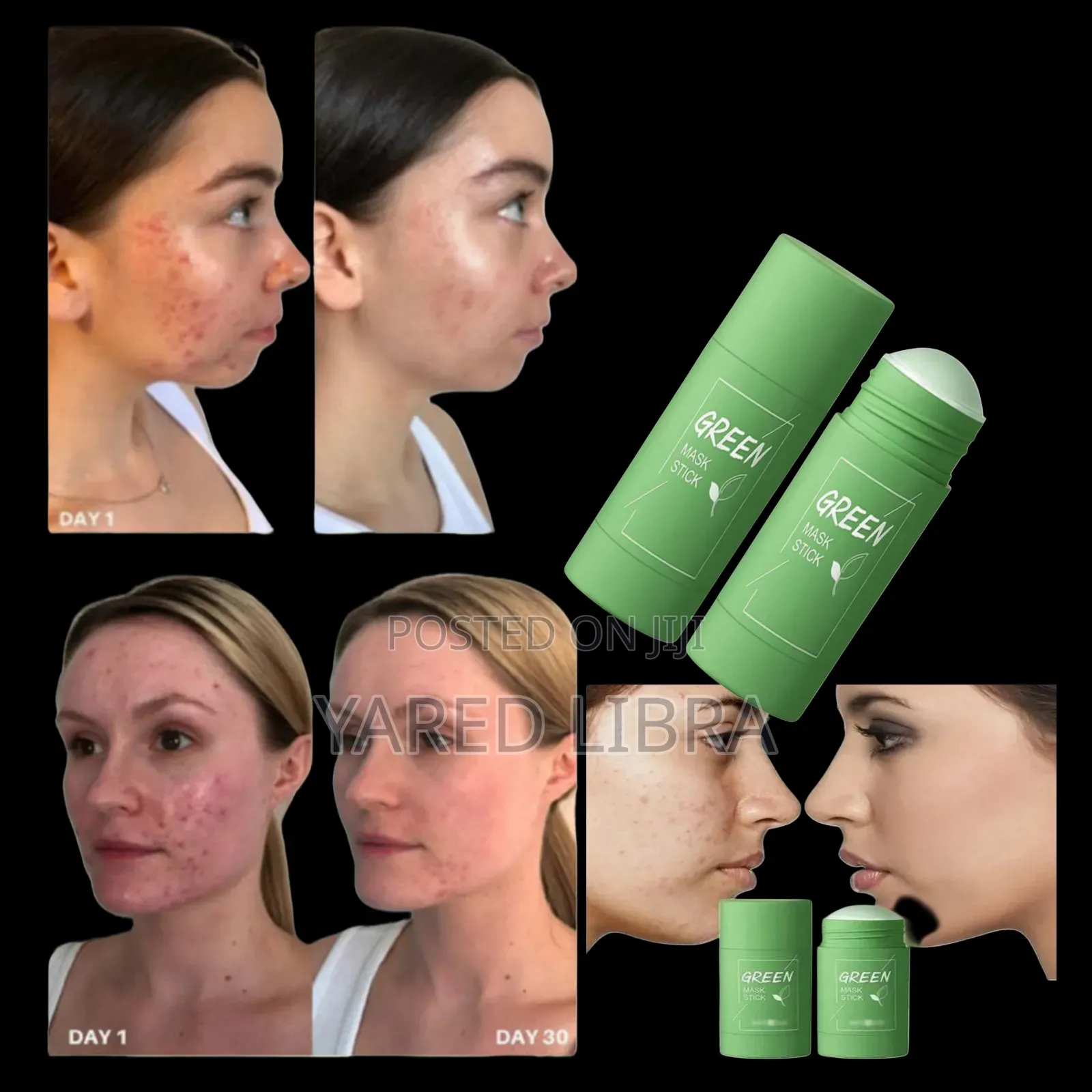 Green Makes ብጉር ማድያት ያጠፋል