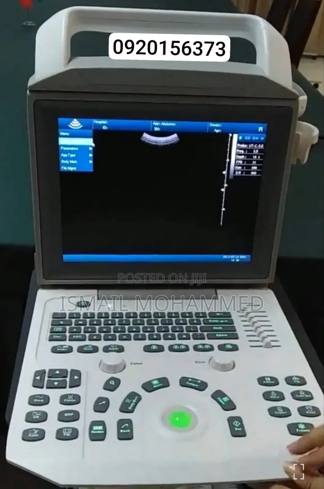 Zoncare I-50 Ultrasound