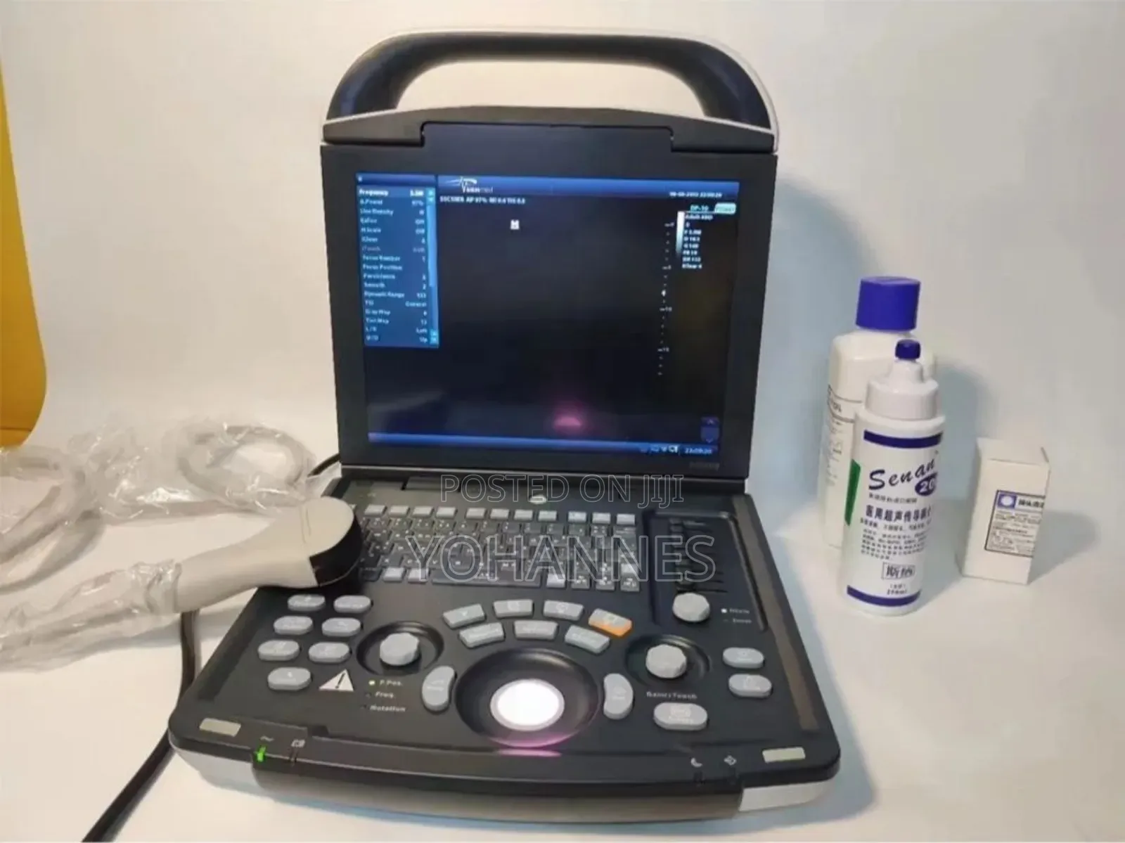 Ultrasound (Dp 10)