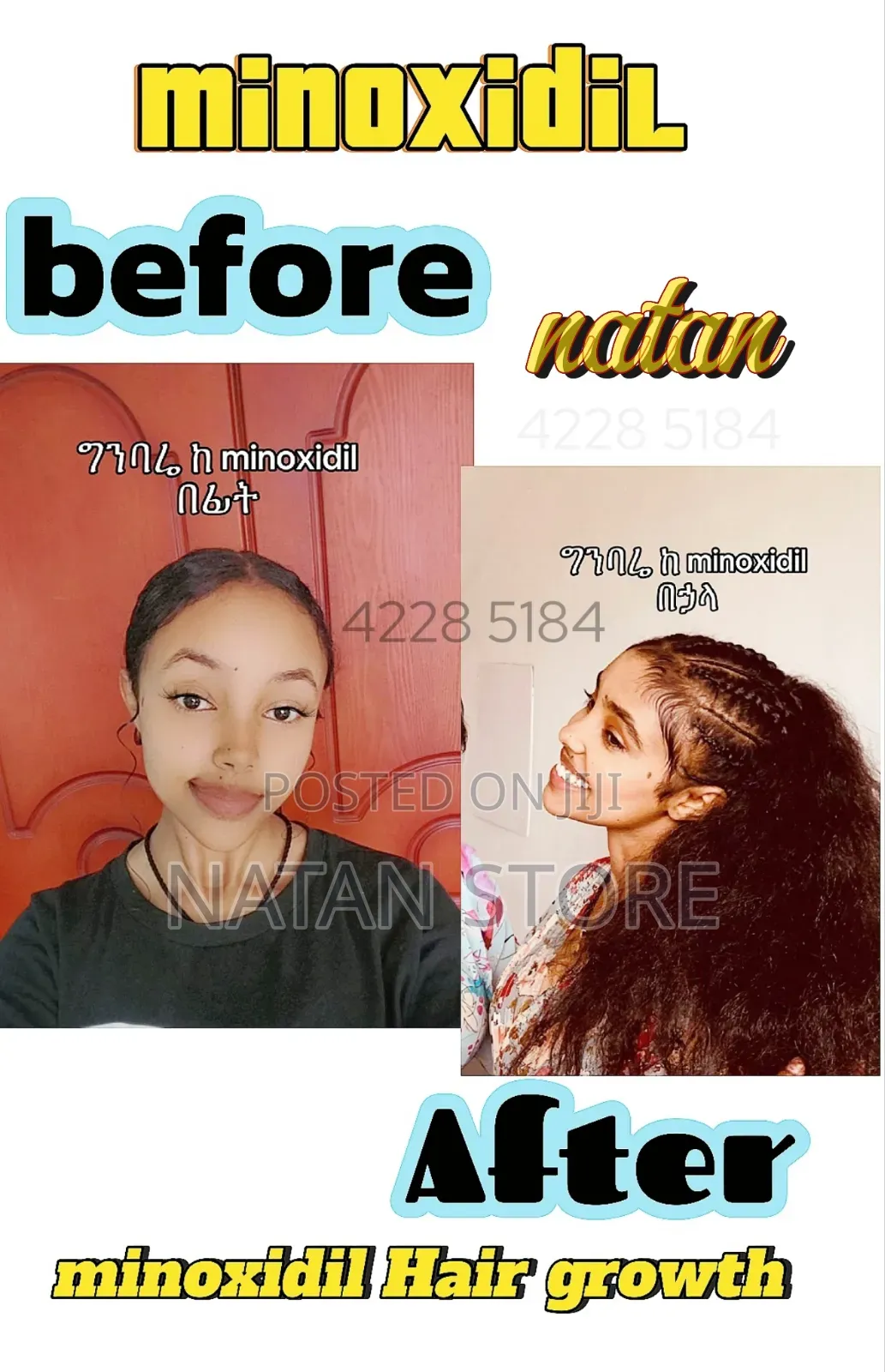 Hairgrow Minoxidil Spray Available