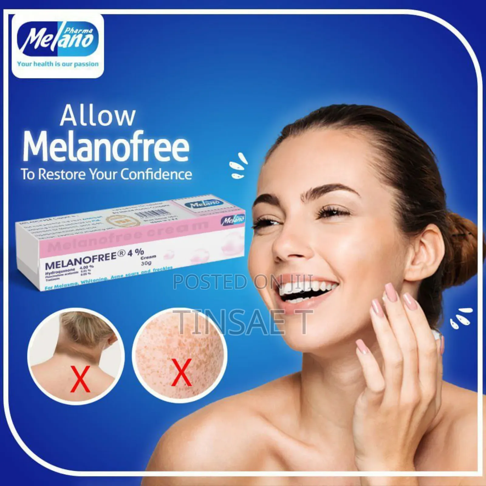 ማድያትን በቀላሉ የሚያጠፋ ሜላኖ ፍሪ ክሬም Melano Free Lightening Cream