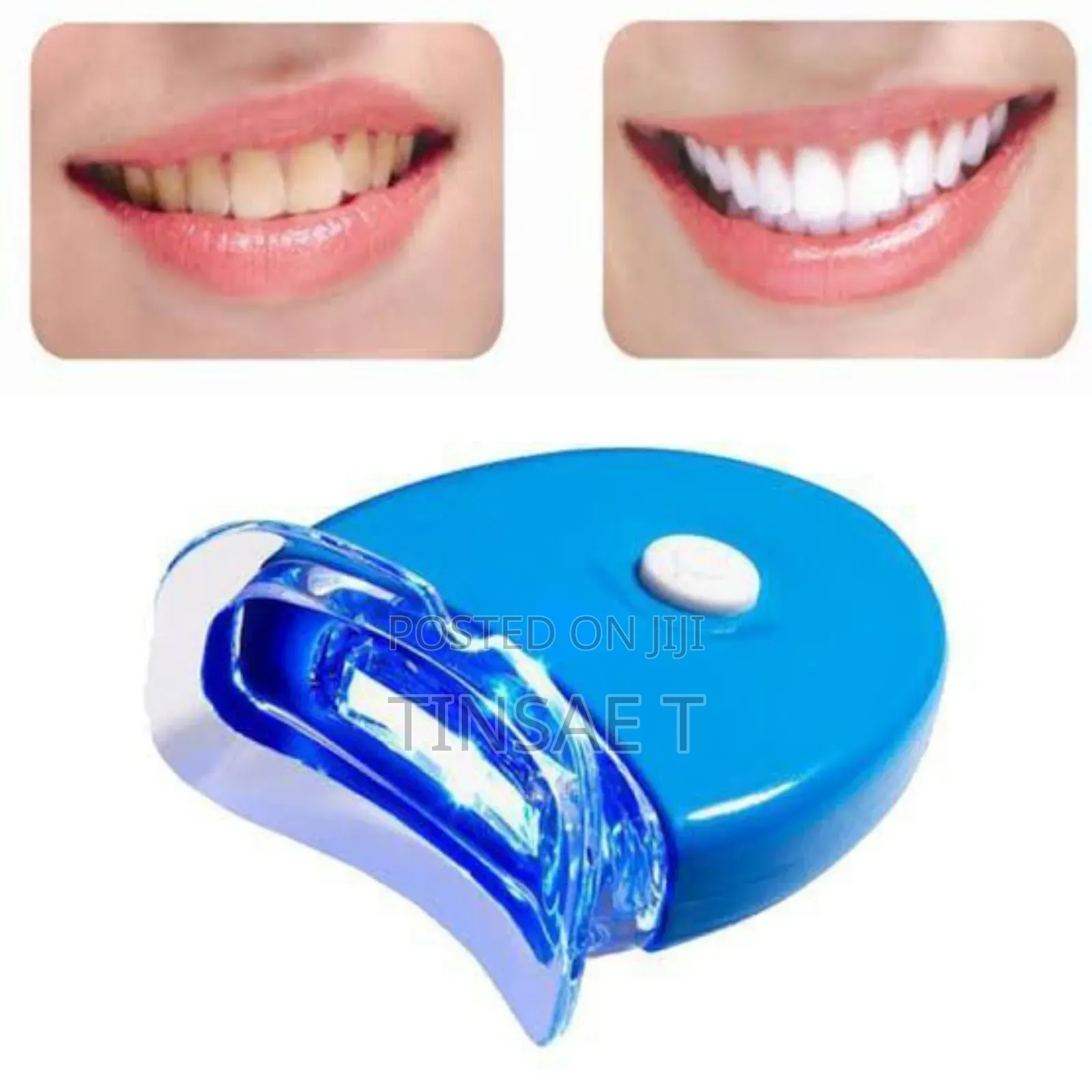 Led Teeth Whitening/ጥርስ ማንፃ