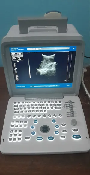 Xf-300 Ultrasound