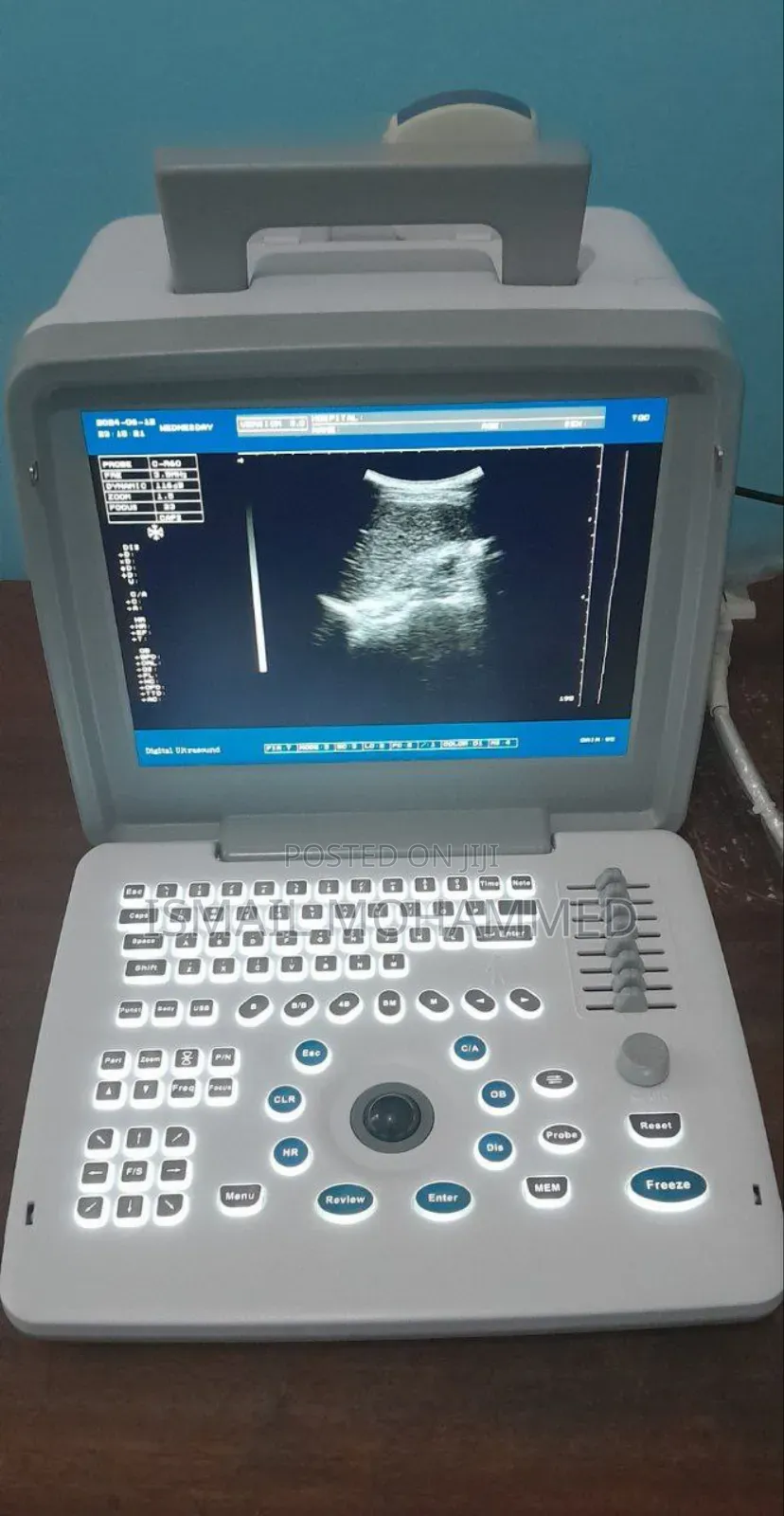Xf-300 Ultrasound