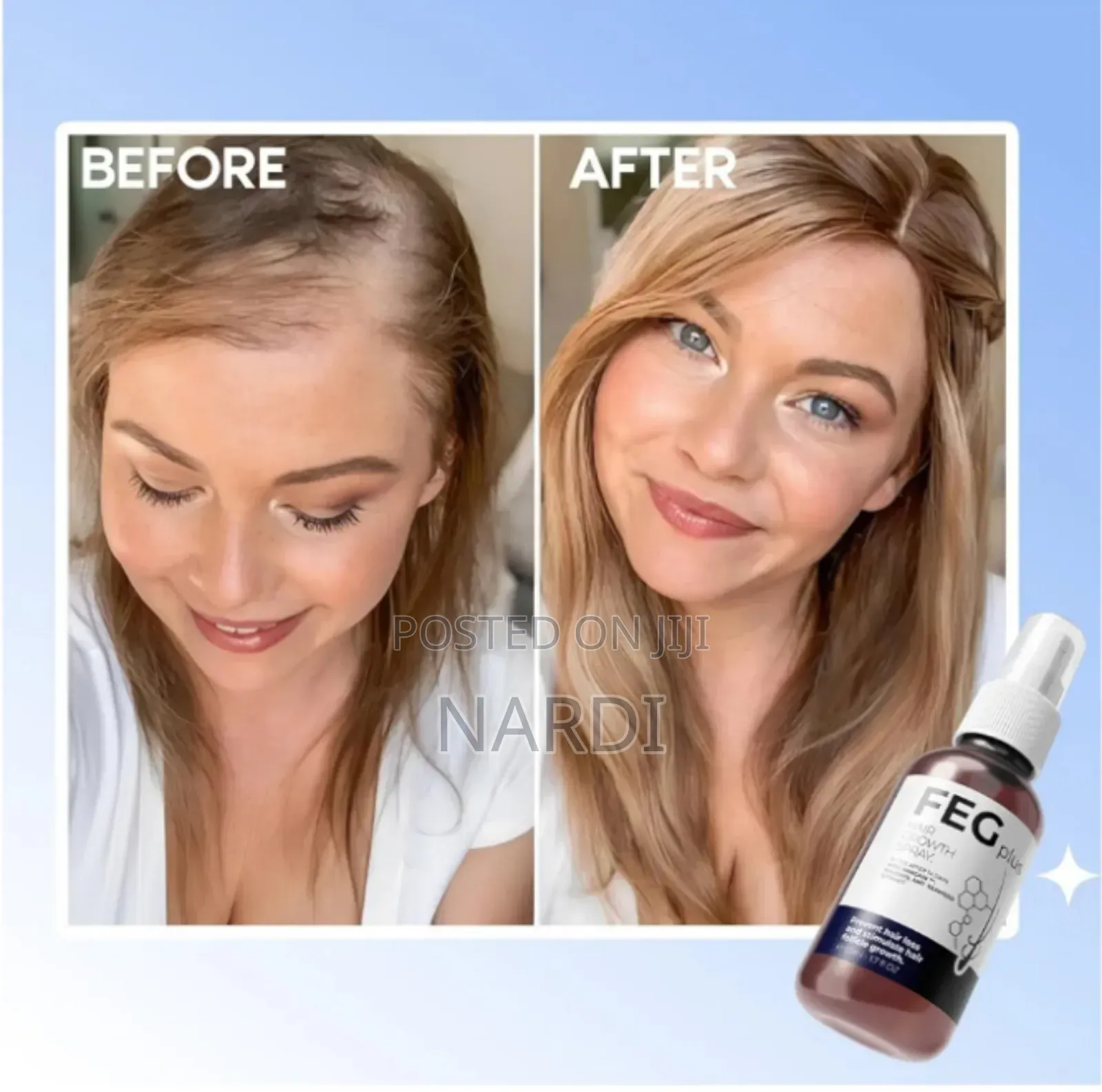 Feg Plus Hair Growth Spray