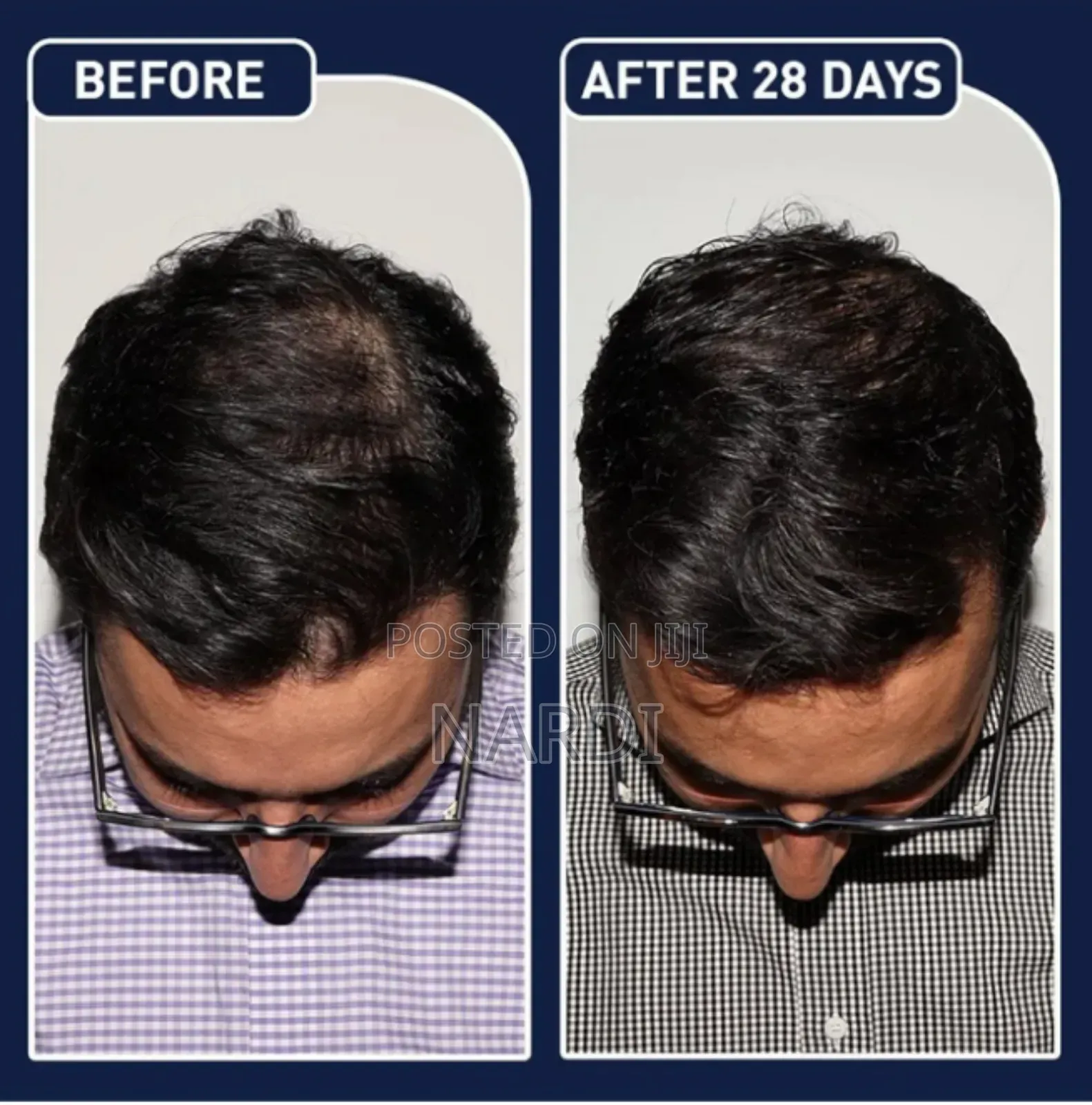 Feg Plus Hair Growth Spray