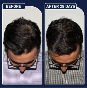 Feg Plus Hair Growth Spray