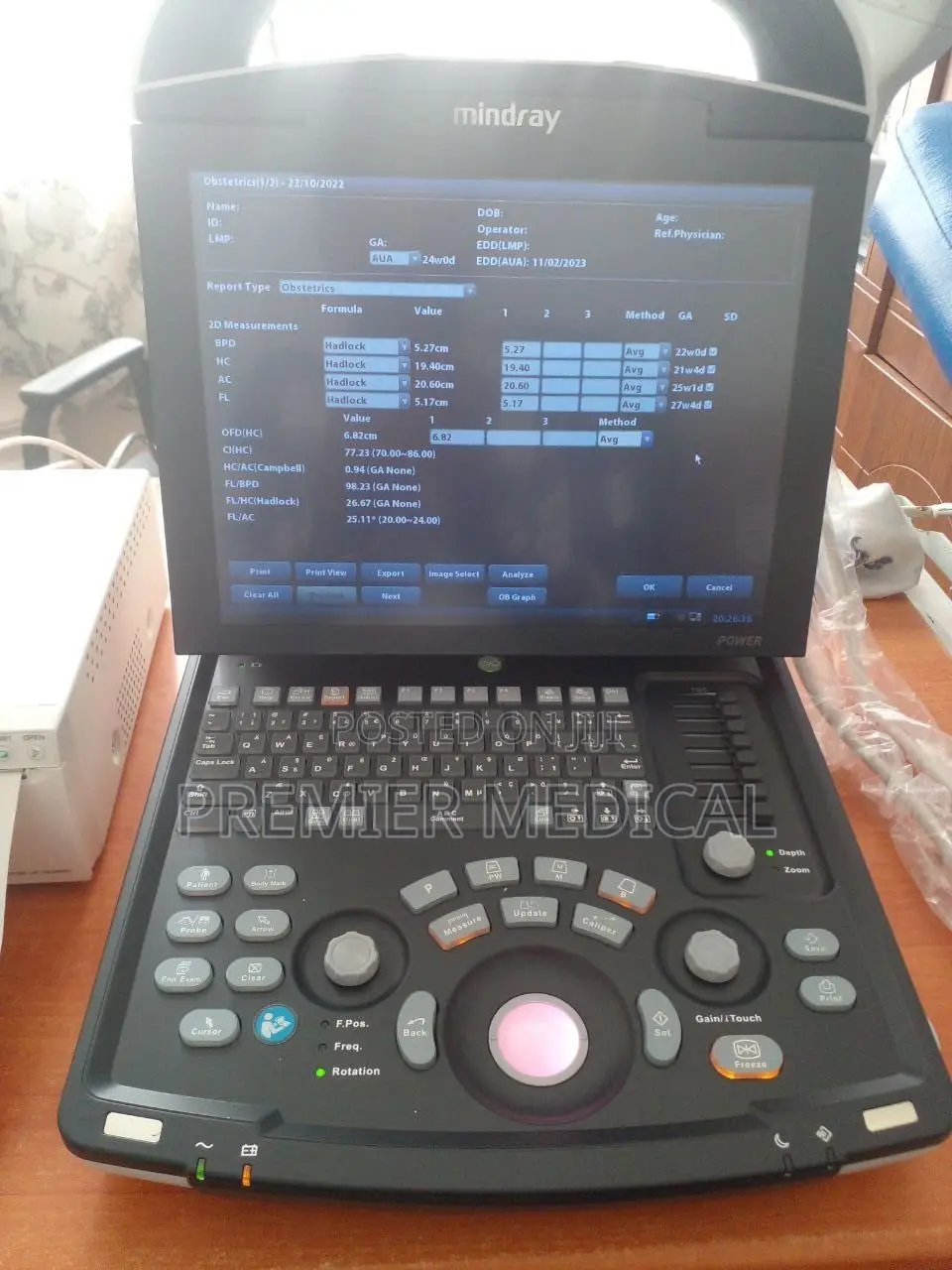 Mindray Dp-15 Ultrasound Machine