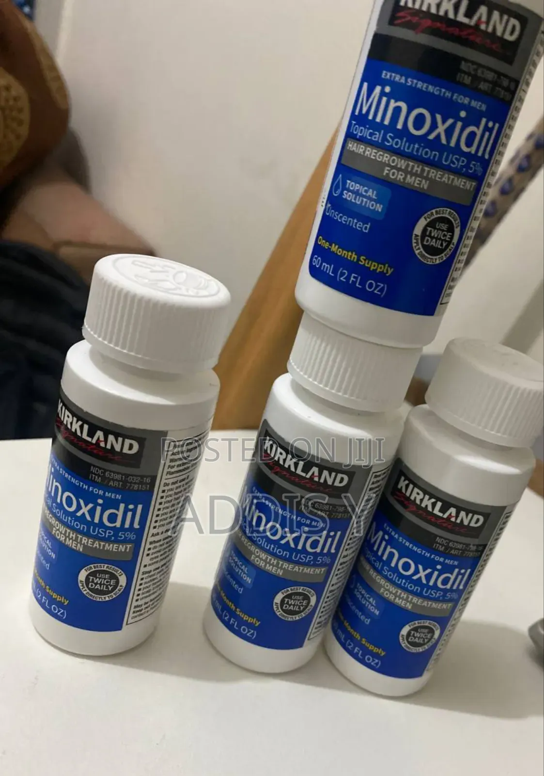 Hair Loss Doesn’T Wait – Neither Should You