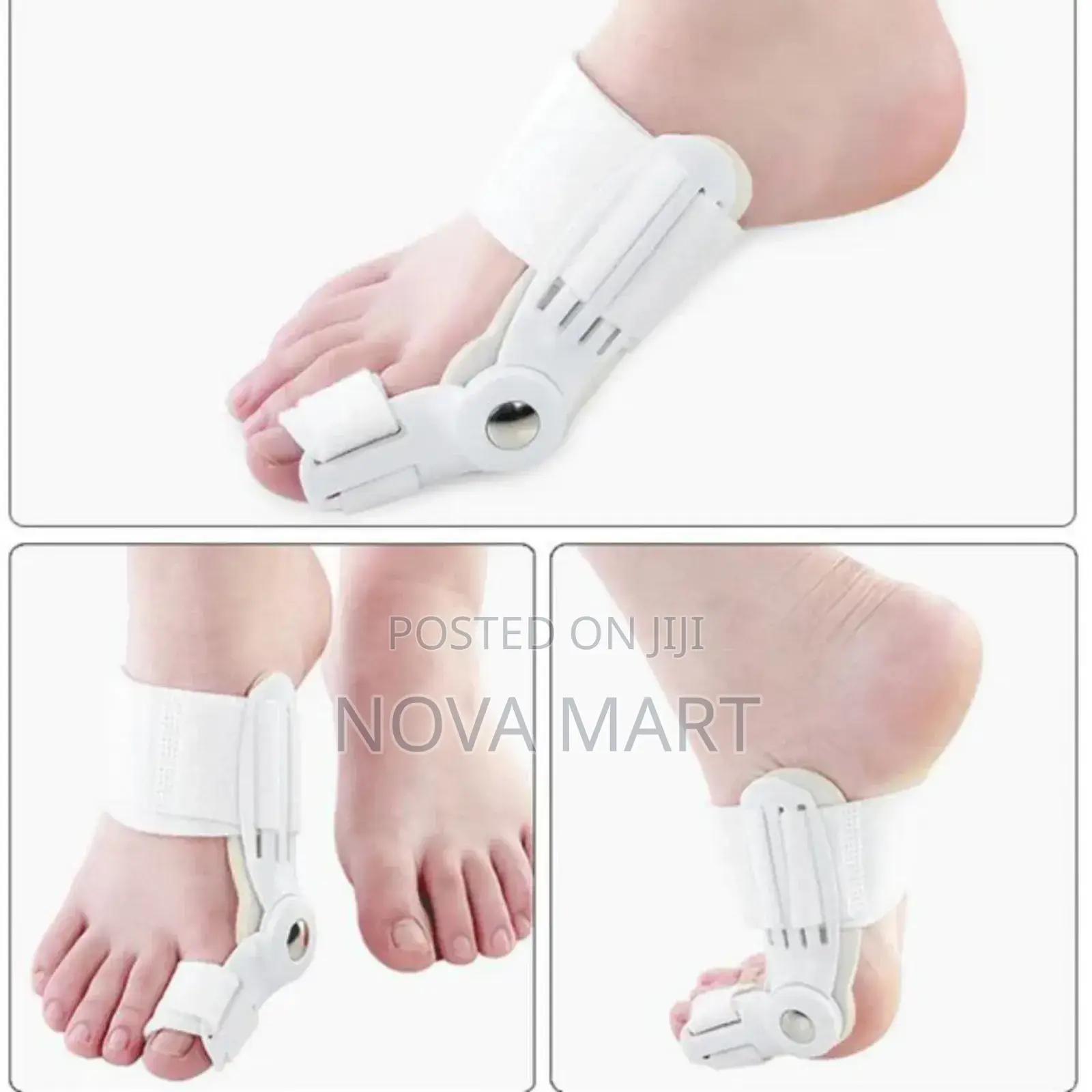 Orthopedic Beunion Toe Corrector