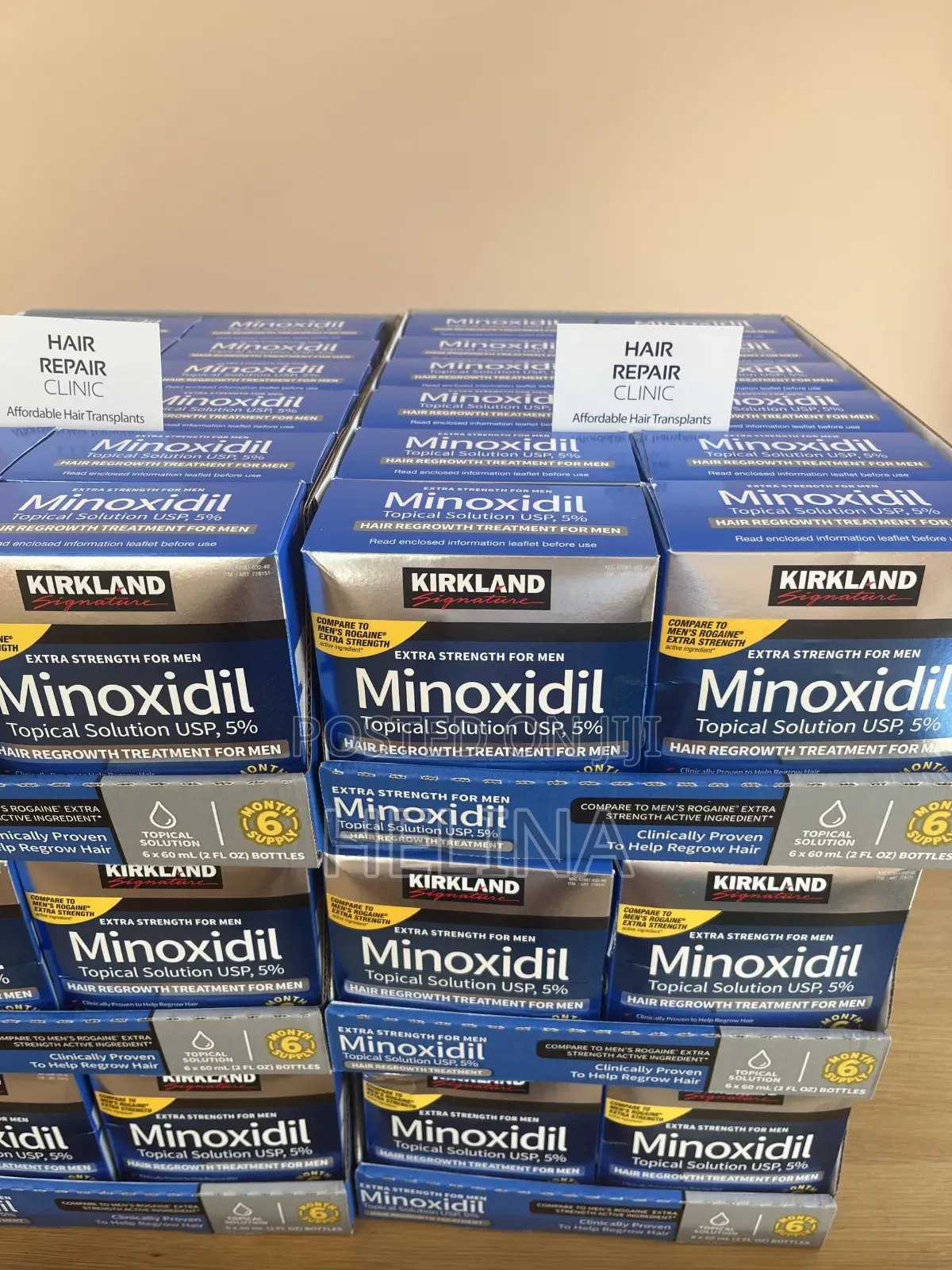 Affordable Hair Transplant Original Kirkland Minoxidil 5%