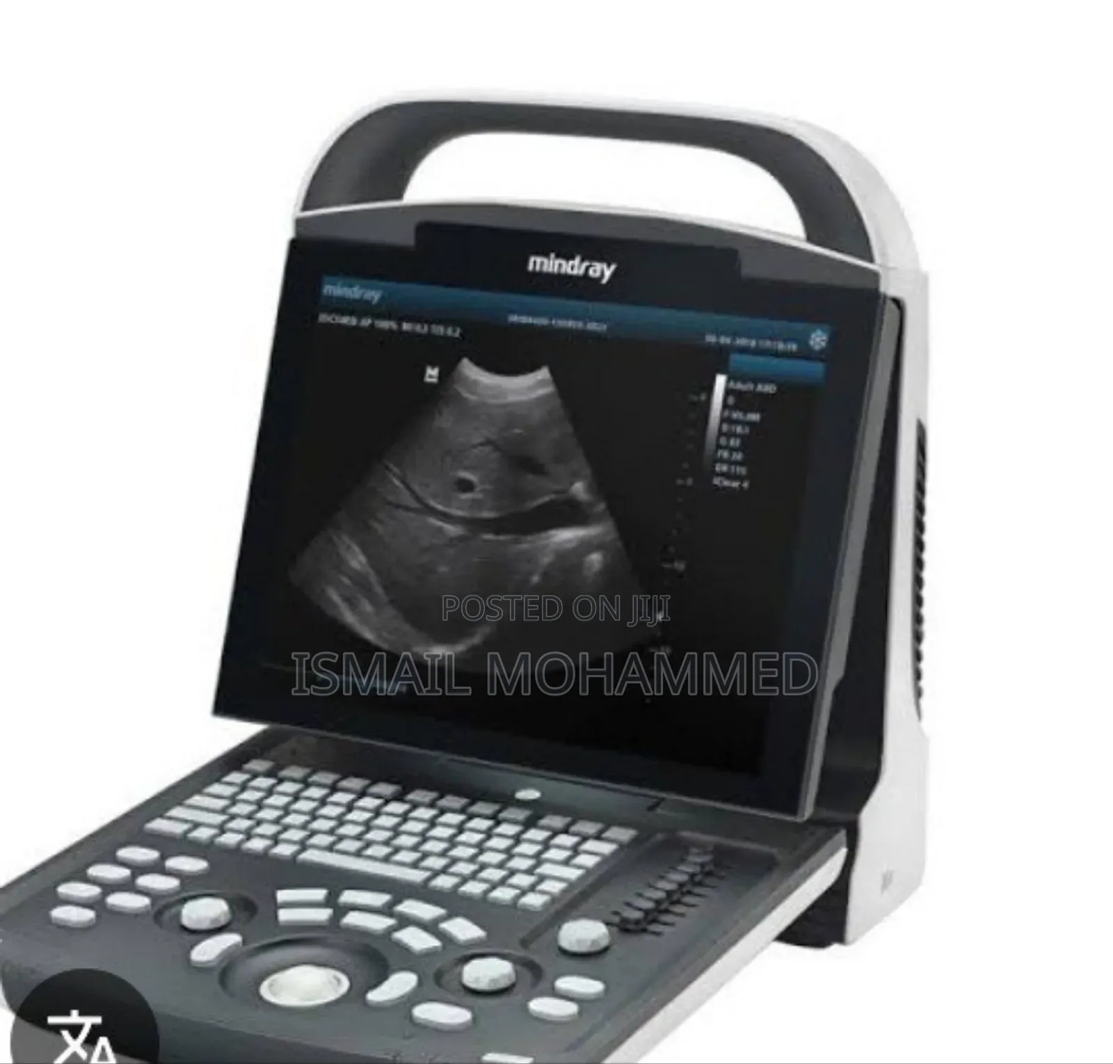 Mindray Dp 10 Ultrasound