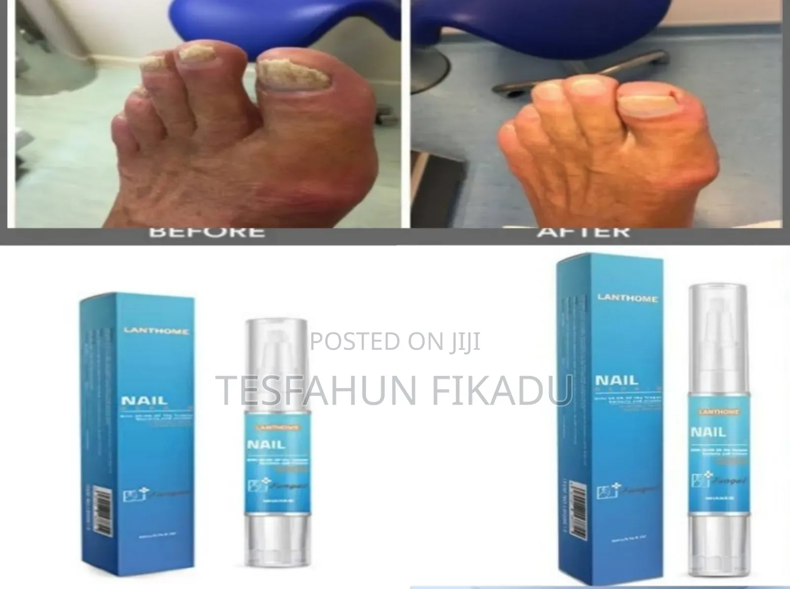 የጥፍር ችግርዎን ሙሉ ለሙሉ የሚያስተካክል