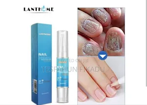 የጥፍር ችግርዎን ሙሉ ለሙሉ የሚያስተካክል