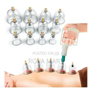 Suction Cupping
