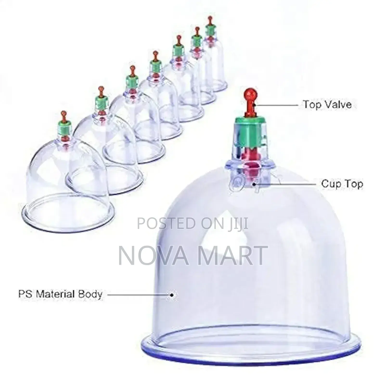 Suction Cupping