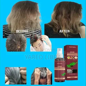 Photo - Herbal Gray ሽበት እስከወዲያኛው ያጠፋል